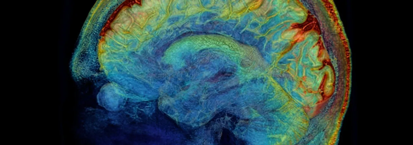 Mapping the Brain