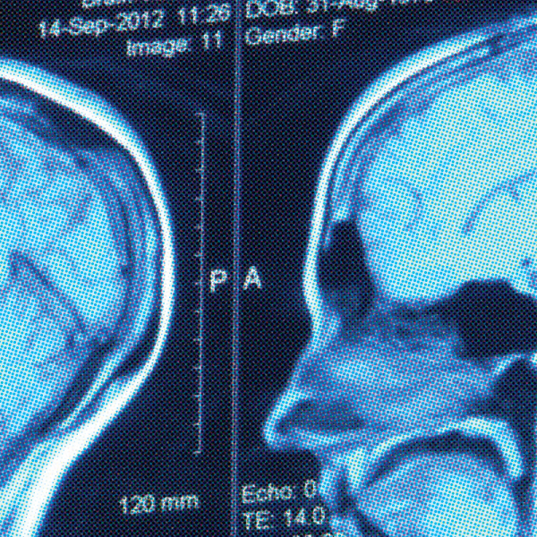 Biology Major Neuroscience