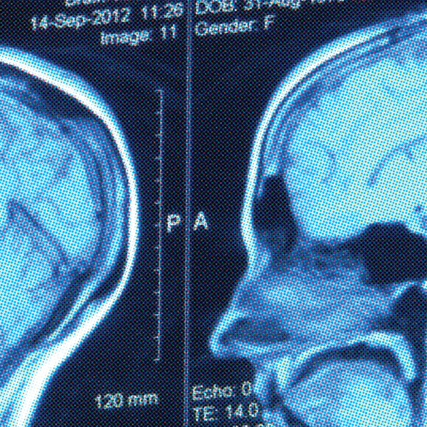 Biology Major Neuroscience