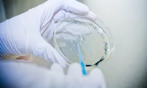 Image of biotech in petri dish.